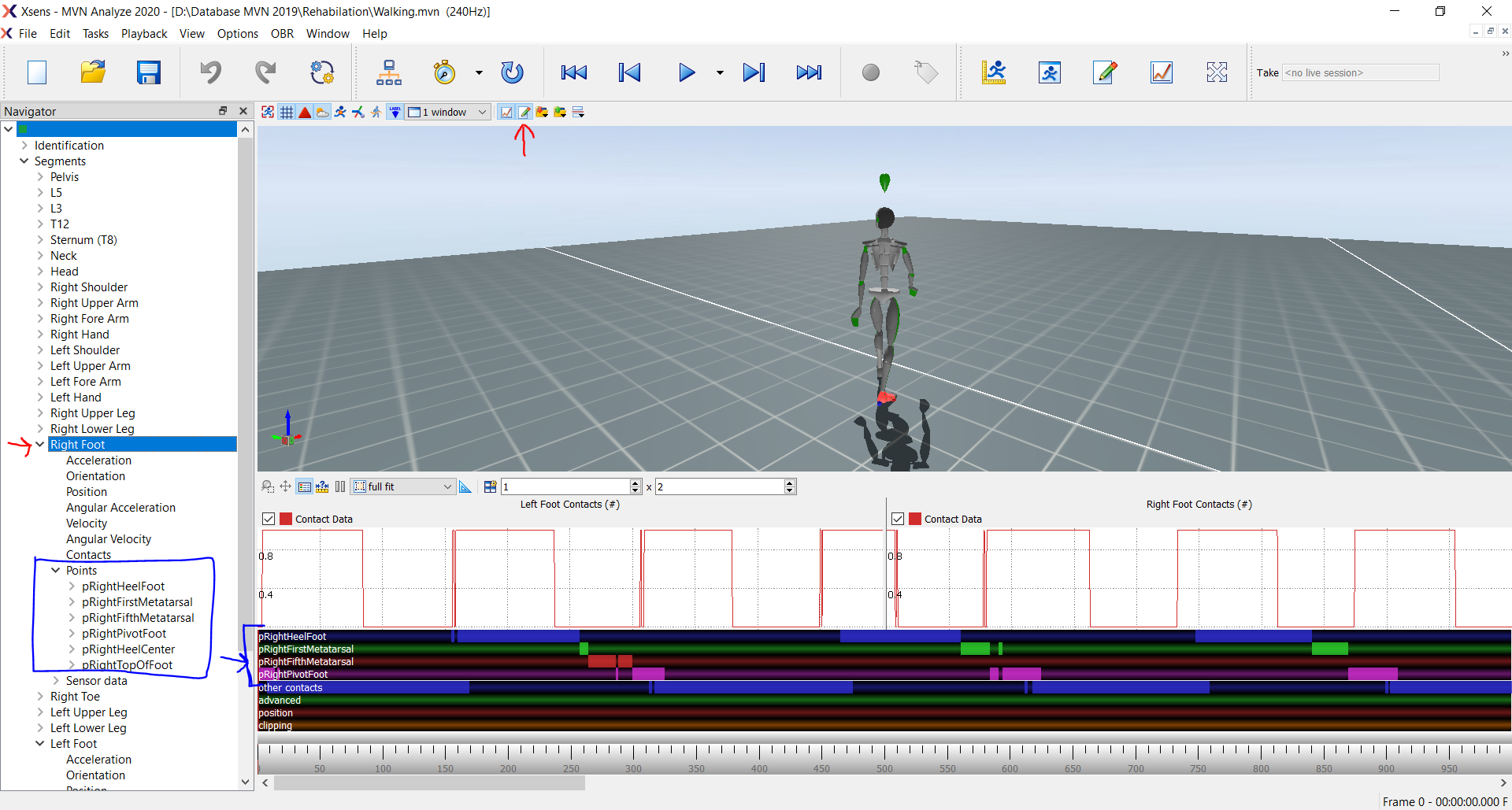 Contacts Points in MVN